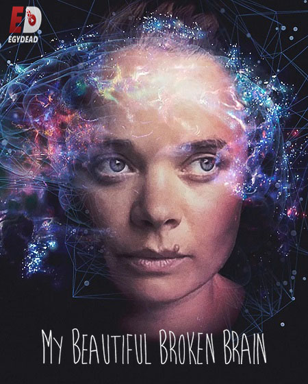  مشاهدة فيلم My Beautiful Broken Brain 2014 مترجم اكوام 